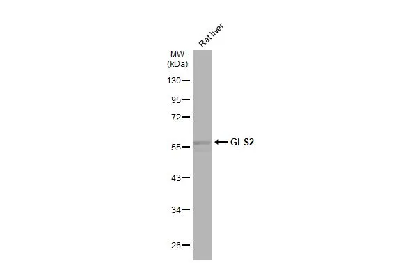 Rat tissue extract (50 μg) was separated by 10% SDS-PAGE, and the membrane was blotted with GLS2 antibody (GTX133243) diluted at 1:500. The HRP-conjugated anti-rabbit IgG antibody (GTX213110-01) was used to detect the primary antibody.