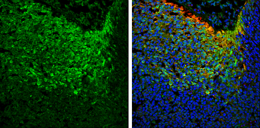 NSE antibody