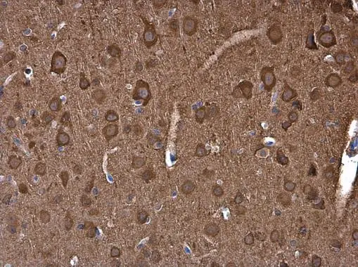 NSE antibody