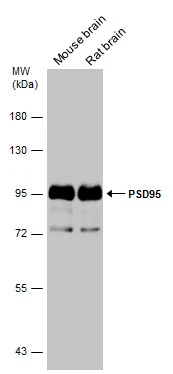 Various tissue extracts (50 μg) were separated by 7.5% SDS-PAGE, and the membrane was blotted with PSD95 antibody (GTX133255) diluted at 1:5000.