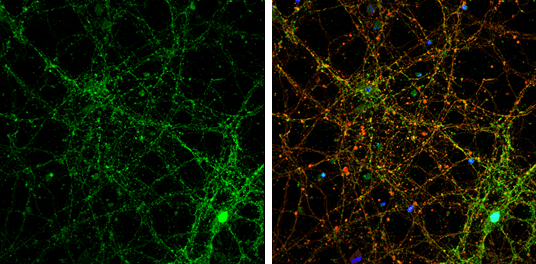 PSD95 antibody detects PSD95 protein by immunofluorescent analysis. Sample: DIV14 rat E18 primary cortical neurons were fixed in 4% paraformaldehyde at RT for 15 min. Green: PSD95 protein stained by PSD95 antibody (GTX133255) diluted at 1:500. Red: beta Tubulin 3/ Tuj1, stained by beta Tubulin 3/ Tuj1 antibody [GT1338] (GTX631831) diluted at 1:500. Blue: Fluoroshield with DAPI (GTX30920).