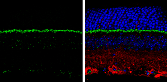PSD95 antibody detects PSD95 protein by immunohistochemical analysis. Samples: Paraffin-embedded mouse retina. Green: PSD95 protein stained by PSD95 antibody (GTX133255) diluted at 1:250. Red: beta Tubulin 3/ Tuj1, a marker, stained by beta Tubulin 3/ Tuj1 antibody [GT1338] (GTX631831) diluted at 1:500. Blue: Fluoroshield with DAPI (GTX30920). 
 Antigen Retrieval: Citrate buffer, pH 6.0, 15 min