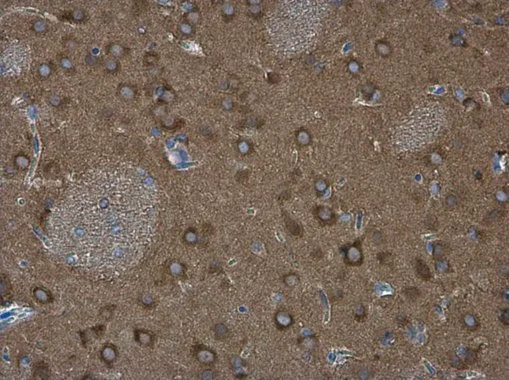 WAVE1 antibody