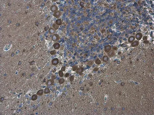 DLGAP1 antibody