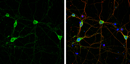 Anti-DLGAP1 antibody (GTX133264) | GeneTex