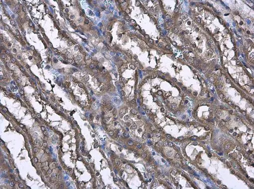 CASK antibody