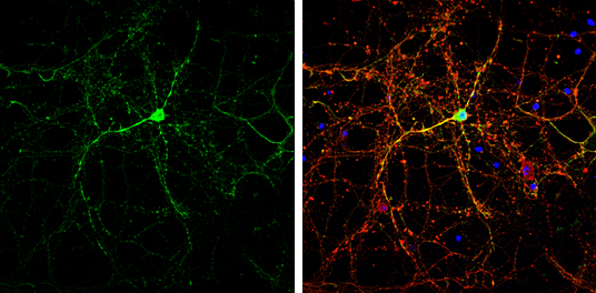 CASK antibody