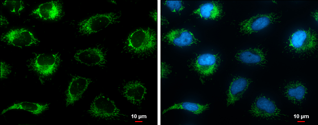 Grp75 antibody detects Grp75 protein at mitochondria by immunofluorescent analysis.