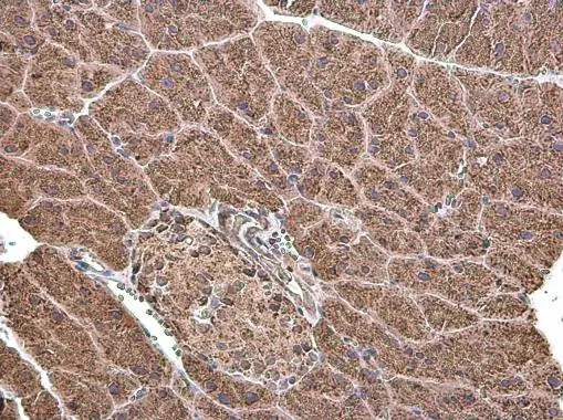 Grp75 antibody