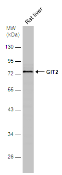 GIT2 antibody