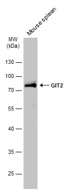 GIT2 antibody