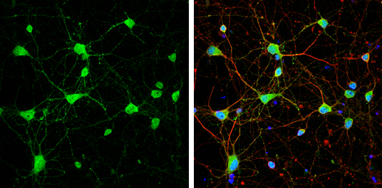 mGluR5 antibody