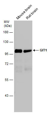 GIT1 antibody
