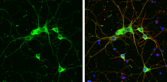 GIT1 antibody