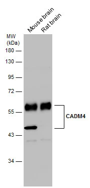 Various tissue extracts (50 μg) were separated by 10% SDS-PAGE, and the membrane was blotted with CADM4 antibody (GTX133294) diluted at 1:1000. The HRP-conjugated anti-rabbit IgG antibody (GTX213110-01) was used to detect the primary antibody.