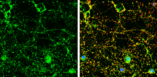 CADM4 antibody detects CADM4 protein by immunofluorescent analysis. Sample: DIV9 rat E18 primary cortical neuron cells were fixed in 4% paraformaldehyde at RT for 15 min. Green: CADM4 stained by CADM4 antibody (GTX133294) diluted at 1:500. Red: beta Tubulin 3/ Tuj1, stained by beta Tubulin 3/ Tuj1 antibody [GT1338] (GTX631831) diluted at 1:500. Blue: Fluoroshield with DAPI (GTX30920).