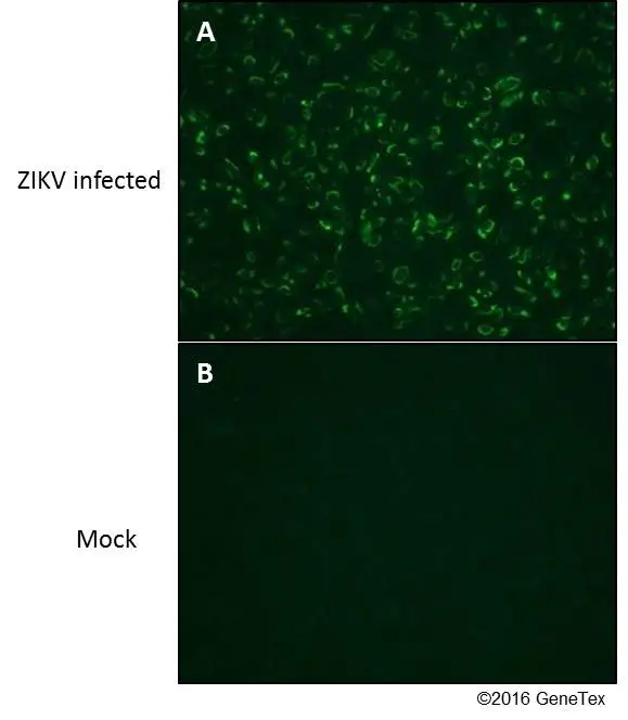 Immunofluorescent analysis of Zika Virus-PRVABC59 infected (A) and non-infected (B) vero cells using Zika virus NS1 protein antibody (GTX133306). Green:Zika virus NS1 protein antibody (GTX133306) diluted at 1:4000. Immunofluorescent analysis of Zika Virus-PRVABC59 infected (A) and non-infected (B) vero cells using Zika virus NS1 protein antibody (GTX133306). Green:Zika virus NS1 protein antibody (GTX133306) diluted at 1:4000.