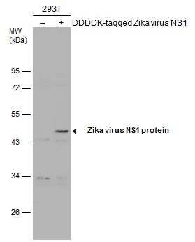 Non-transfected (–) and transfected (+) 293T whole cell extracts (30 μg) were separated by 10% SDS-PAGE, and the membrane was blotted with Zika virus NS1 protein antibody (GTX133306) diluted at 1:220. The HRP-conjugated anti-rabbit IgG antibody (GTX213110-01) was used to detect the primary antibody. Non-transfected (–) and transfected (+) 293T whole cell extracts (30 μg) were separated by 10% SDS-PAGE, and the membrane was blotted with Zika virus NS1 protein antibody (GTX133306) diluted at 1:220. The HRP-conjugated anti-rabbit IgG antibody (GTX213110-01) was used to detect the primary antibody.