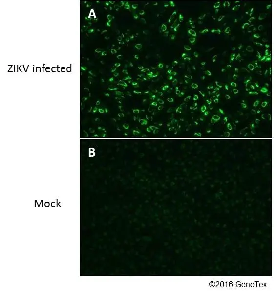 Anti-Zika virus NS1 protein antibody (GTX133307) | GeneTex