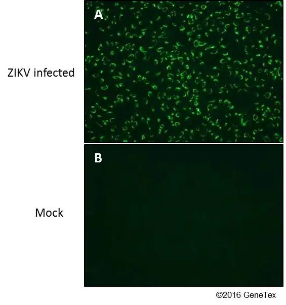 Anti-Zika virus NS4B protein antibody (GTX133311) | GeneTex