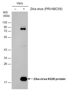 Non-infected (–) and infected (+) Vero whole cell extracts (30 μg) were separated by 12% SDS-PAGE, and the membrane was blotted with Zika virus NS2B protein antibody (GTX133318) diluted at 1:15000.