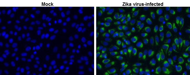 Zika virus NS2B protein antibody detects Zika virus NS2B protein at cytoplasm by immunofluorescent analysis. Sample: Vero cells were fixed in 4% paraformaldehyde at RT for 30 min. Green: Zika virus NS2B stained by Zika virus NS2B protein antibody (GTX133318) diluted at 1:1000. Blue: nuclear staining.