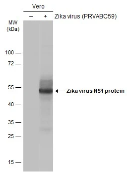 Non-infected (–) and infected (+) Vero whole cell extracts were separated by gradient gel, and the membrane was blotted with Zika virus NS1 protein antibody (GTX133324) diluted at 1:2500. Non-infected (–) and infected (+) Vero whole cell extracts were separated by gradient gel, and the membrane was blotted with Zika virus NS1 protein antibody (GTX133324) diluted at 1:2500.