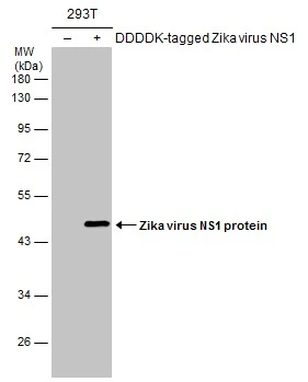 Non-transfected (–) and transfected (+) 293T whole cell extracts (30 μg) were separated by 10% SDS-PAGE, and the membrane was blotted with Zika virus NS1 protein antibody (GTX133324) diluted at 1:10000. The HRP-conjugated anti-rabbit IgG antibody (GTX213110-01) was used to detect the primary antibody. Non-transfected (–) and transfected (+) 293T whole cell extracts (30 μg) were separated by 10% SDS-PAGE, and the membrane was blotted with Zika virus NS1 protein antibody (GTX133324) diluted at 1:10000. The HRP-conjugated anti-rabbit IgG antibody (GTX213110-01) was used to detect the primary antibody.
