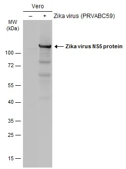 疫 Anti-Zika virus NS5 protein antibody (GTX133327) | GeneTex