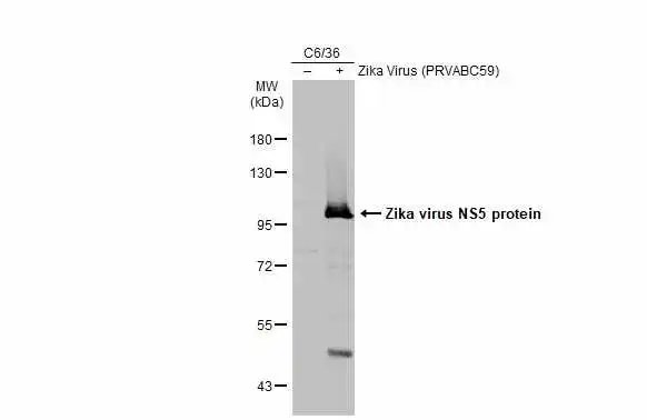 C6/36 whole cell extracts (30 μg) were separated by 7.5% SDS-PAGE, and the membrane was blotted with Zika virus NS5 protein antibody (GTX133328) diluted at 1:1000. The HRP-conjugated anti-rabbit IgG antibody (GTX213110-01) was used to detect the primary antibody. C6/36 whole cell extracts (30 μg) were separated by 7.5% SDS-PAGE, and the membrane was blotted with Zika virus NS5 protein antibody (GTX133328) diluted at 1:1000. The HRP-conjugated anti-rabbit IgG antibody (GTX213110-01) was used to detect the primary antibody.