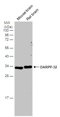 Various tissue extracts (50 ug) were separated by 12% SDS-PAGE,and the membrane was blotted with DARPP-32 antibody (GTX133336) diluted at 1:5000.