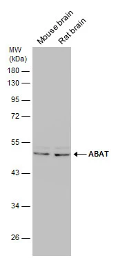 ABAT antibody