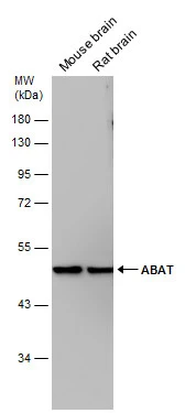 ABAT antibody