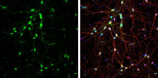 DARPP-32 antibody