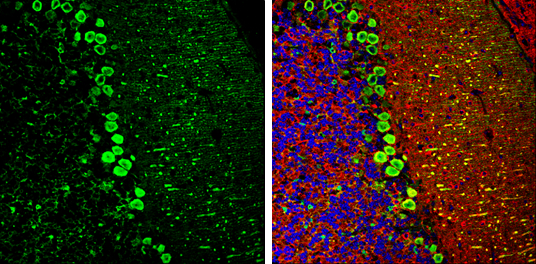 DARPP-32 antibody detects DARPP-32 protein at cell body by immunofluorescent analysis.