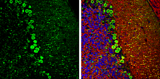 DARPP-32 antibody