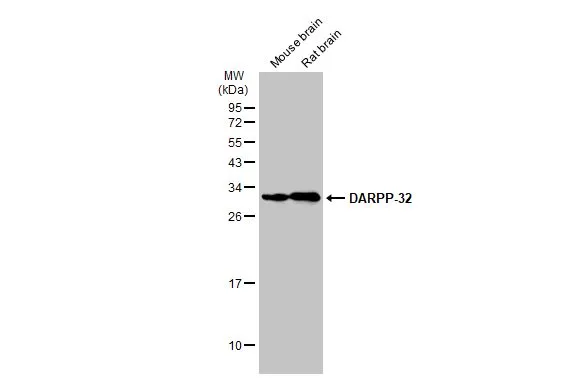 DARPP-32 antibody