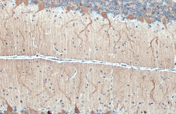 Anti-DARPP-32 antibody (GTX133350) | GeneTex