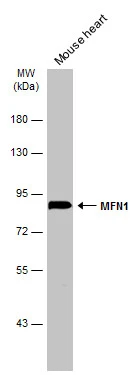 Mouse tissue extract (50 μg) was separated by 7.5% SDS-PAGE, and the membrane was blotted with MFN1 antibody (GTX133351) diluted at 1:1000. The HRP-conjugated anti-rabbit IgG antibody (GTX213110-01) was used to detect the primary antibody.