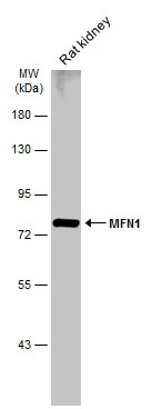 Rat tissue extract (50 μg) was separated by 7.5% SDS-PAGE, and the membrane was blotted with MFN1 antibody (GTX133351) diluted at 1:1000. The HRP-conjugated anti-rabbit IgG antibody (GTX213110-01) was used to detect the primary antibody.