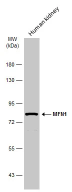 Human tissue extract (30 μg) was separated by 7.5% SDS-PAGE, and the membrane was blotted with MFN1 antibody (GTX133351) diluted at 1:2000. The HRP-conjugated anti-rabbit IgG antibody (GTX213110-01) was used to detect the primary antibody.
