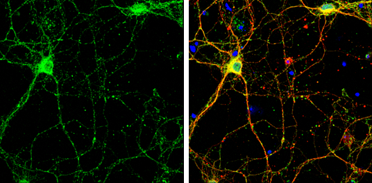 SHANK2 antibody