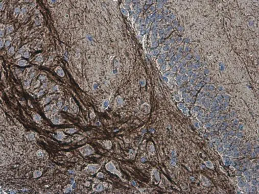 alpha Internexin antibody