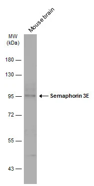 Semaphorin 3E antibody
