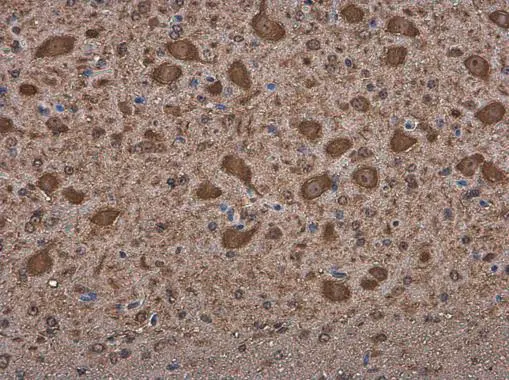 MARS antibody