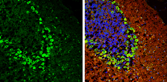 MARS antibody