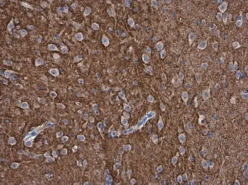 pan Synuclein antibody