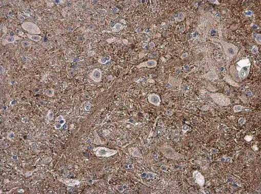 pan Synuclein antibody