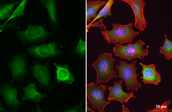 GSK3 beta antibody detects GSK3 beta protein at cytoplasm by immunofluorescent analysis. Sample: HeLa cells were fixed in 4% paraformaldehyde at RT for 15 min. Green: GSK3 beta stained by GSK3 beta antibody (GTX133372) diluted at 1:500. Red: phalloidin, a cytoskeleton marker diluted at 1:200. Blue: Hoechst 33342 staining.