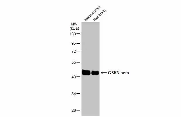 Various tissue extracts (50 μg) were separated by 10% SDS-PAGE, and the membrane was blotted with GSK3 beta antibody (GTX133372) diluted at 1:1000. The HRP-conjugated anti-rabbit IgG antibody (GTX213110-01) was used to detect the primary antibody.